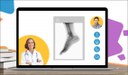 CompuGroup Medical und BKK Linde bieten gemeinsam mit „CLICKDOC“ einen neuen Service zur Online-Terminvereinbarung für Patienten an