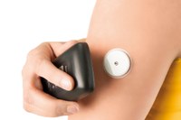 High-Tech-Sensor für Kinder mit Typ-1-Diabetes