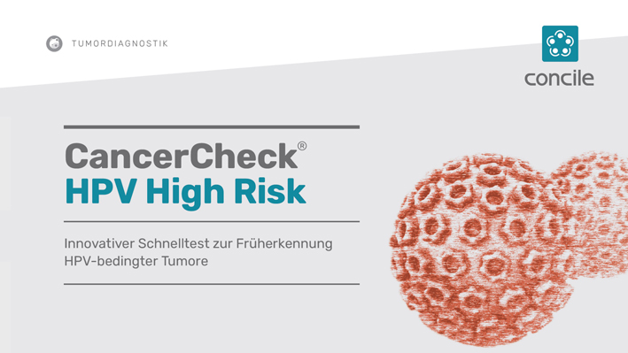 Innovativer Schnelltest erkennt mit einem Tropfen Blut HPV-bedingte Karzinome direkt in der Praxis
